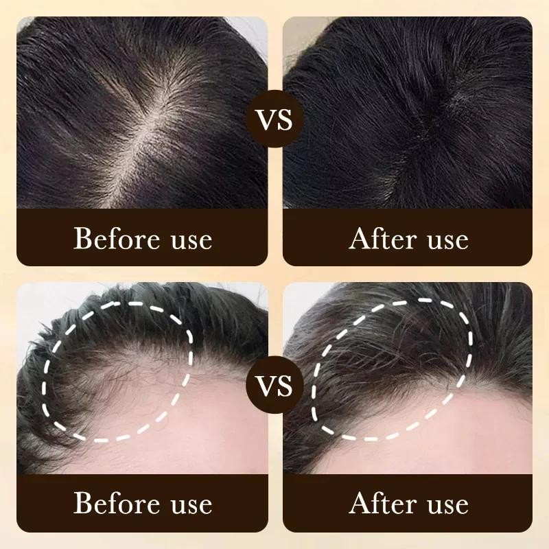 Olio per Crescita Rapida dei C - Ingrown Hair Serum recensione e prezzo
