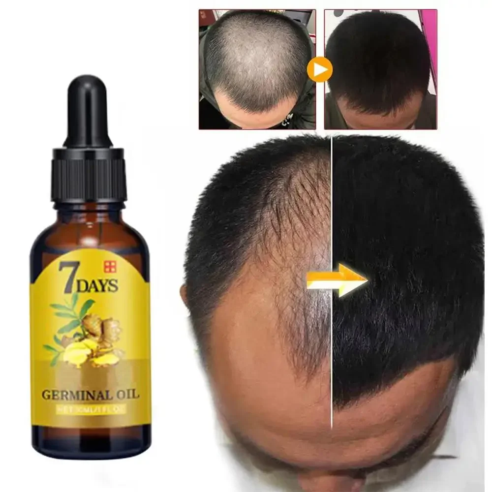 Crescita dei capelli Zenzero C - Ingrown Hair Serum recensione e prezzo